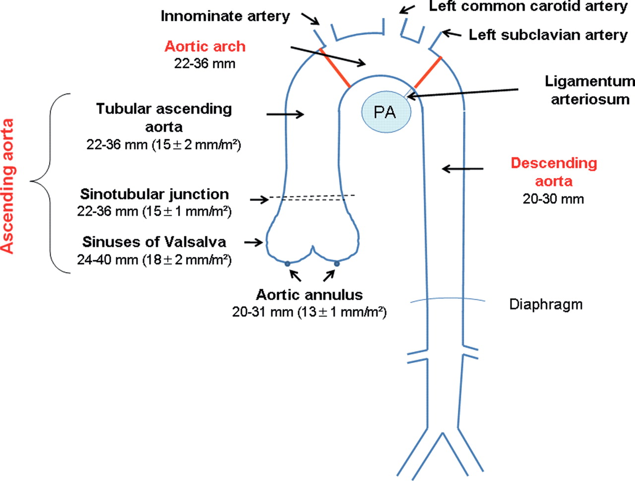 Aorta Aorta: Anatomy,
